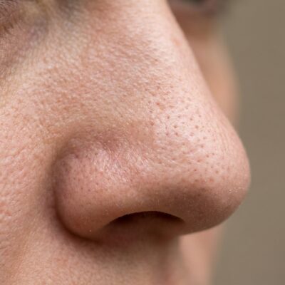 Image for choice number 5